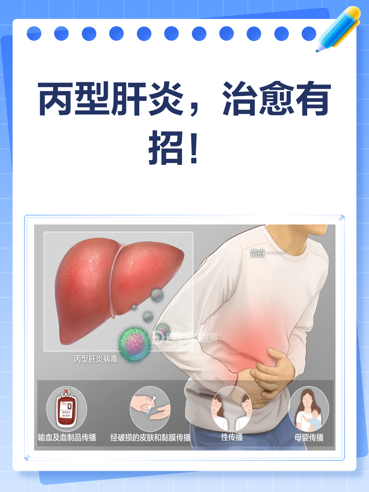 丙型病毒性肝炎严重吗