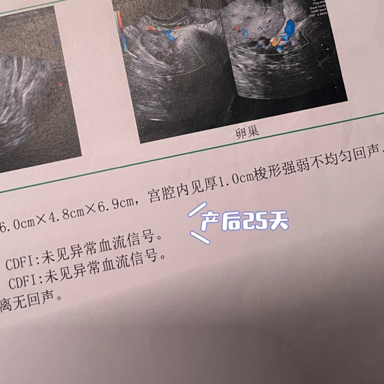 产后胎膜残留怎么办