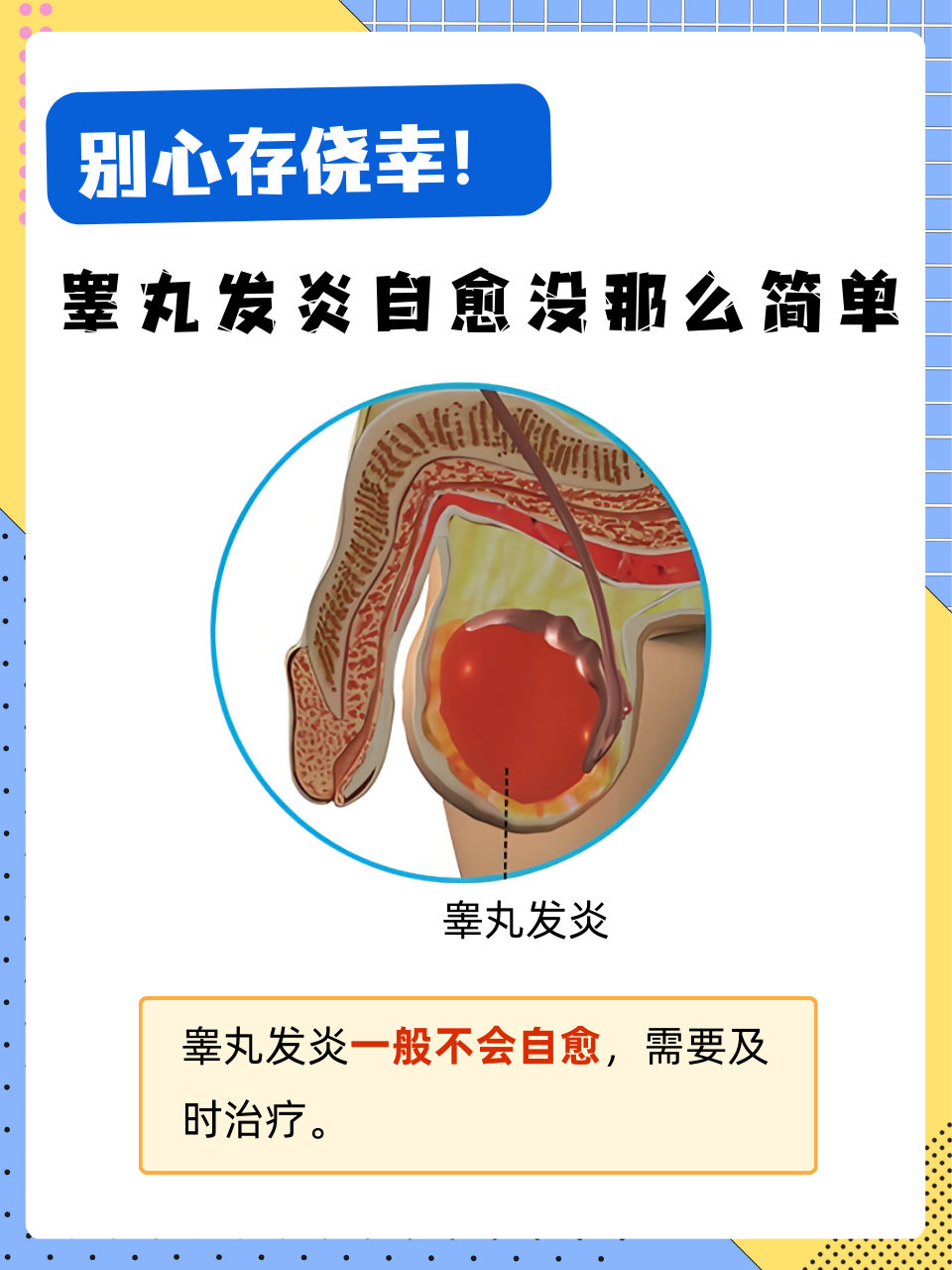 睾丸炎的症状有何体现