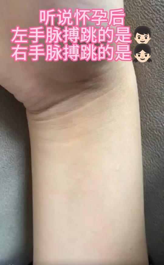 手腕动脉在哪(并不是想自杀