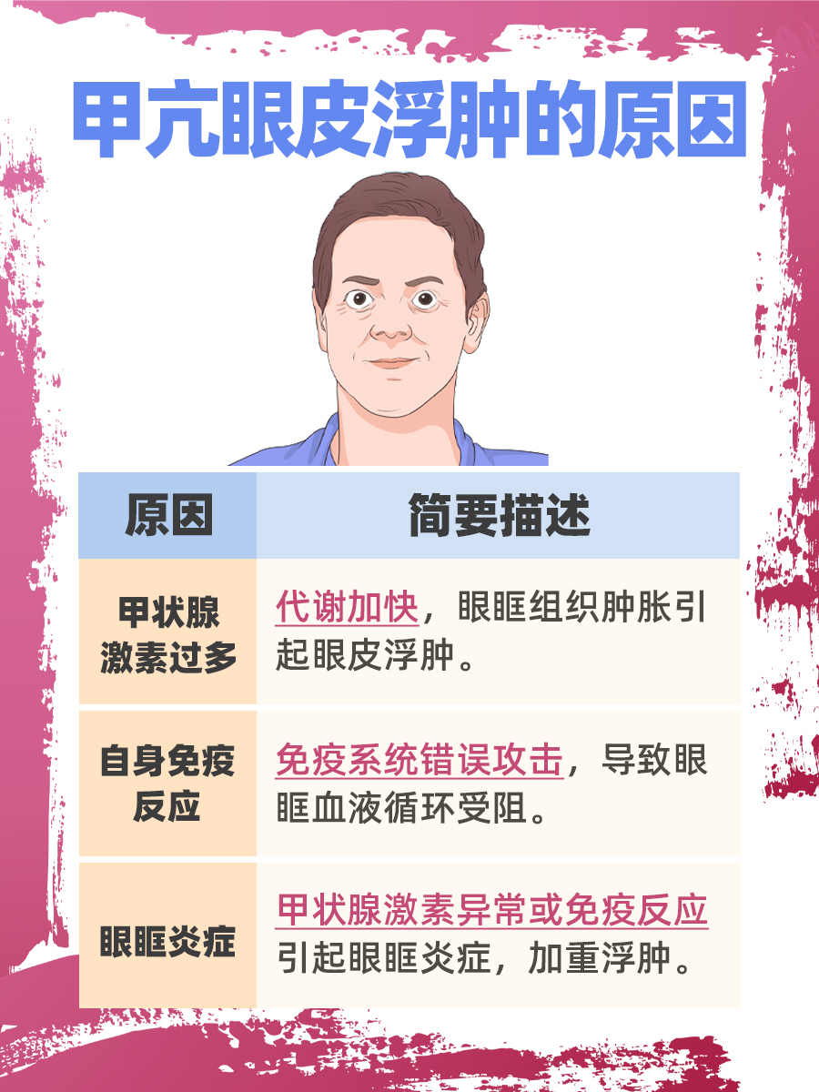 引起甲亢的原因有哪些