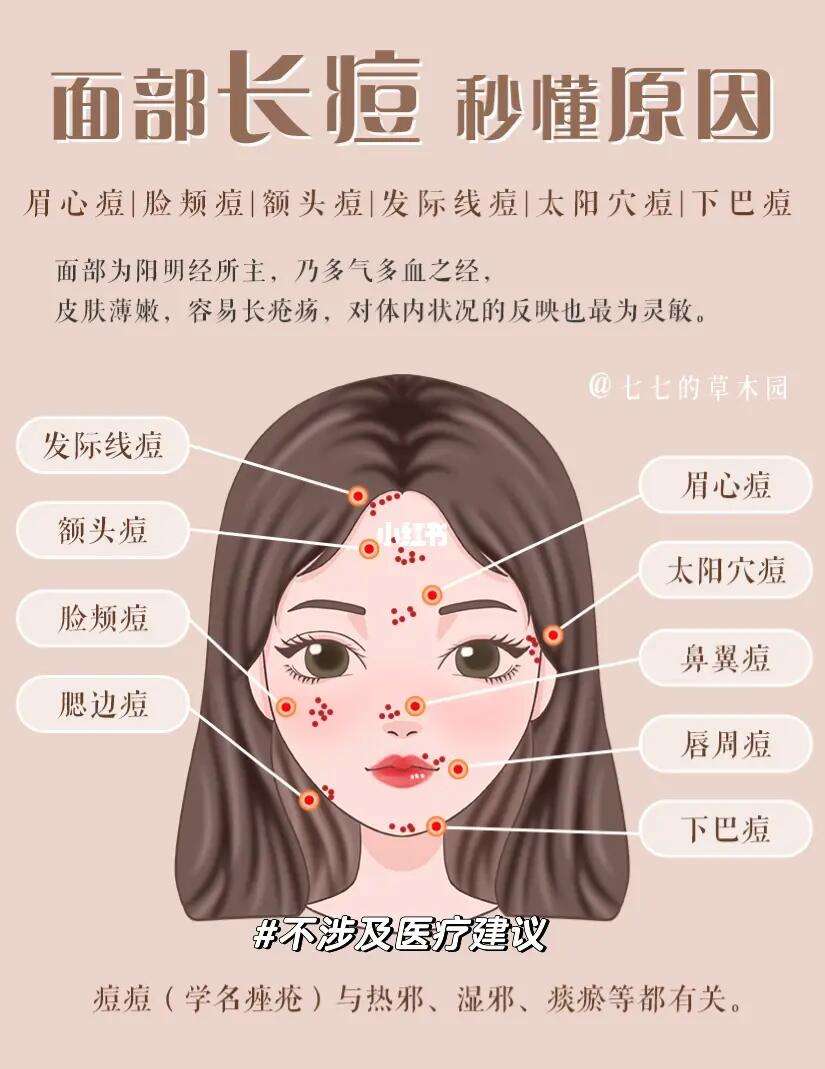 长痘痘的原因