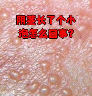 龟头红肿什么情况