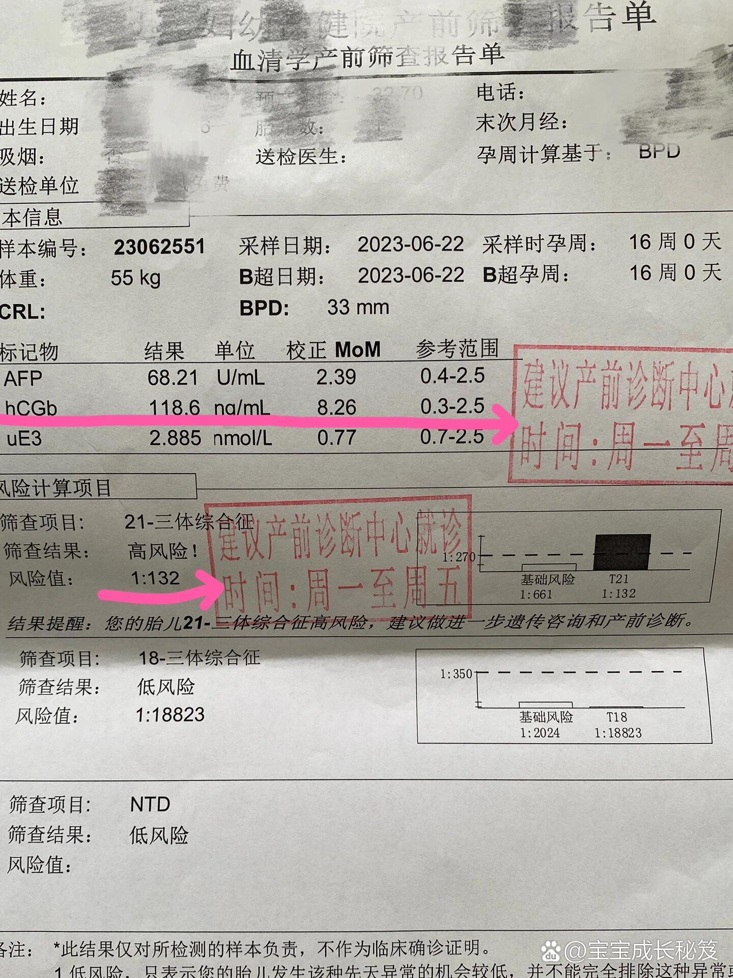 唐筛21三体高风险是什么情况