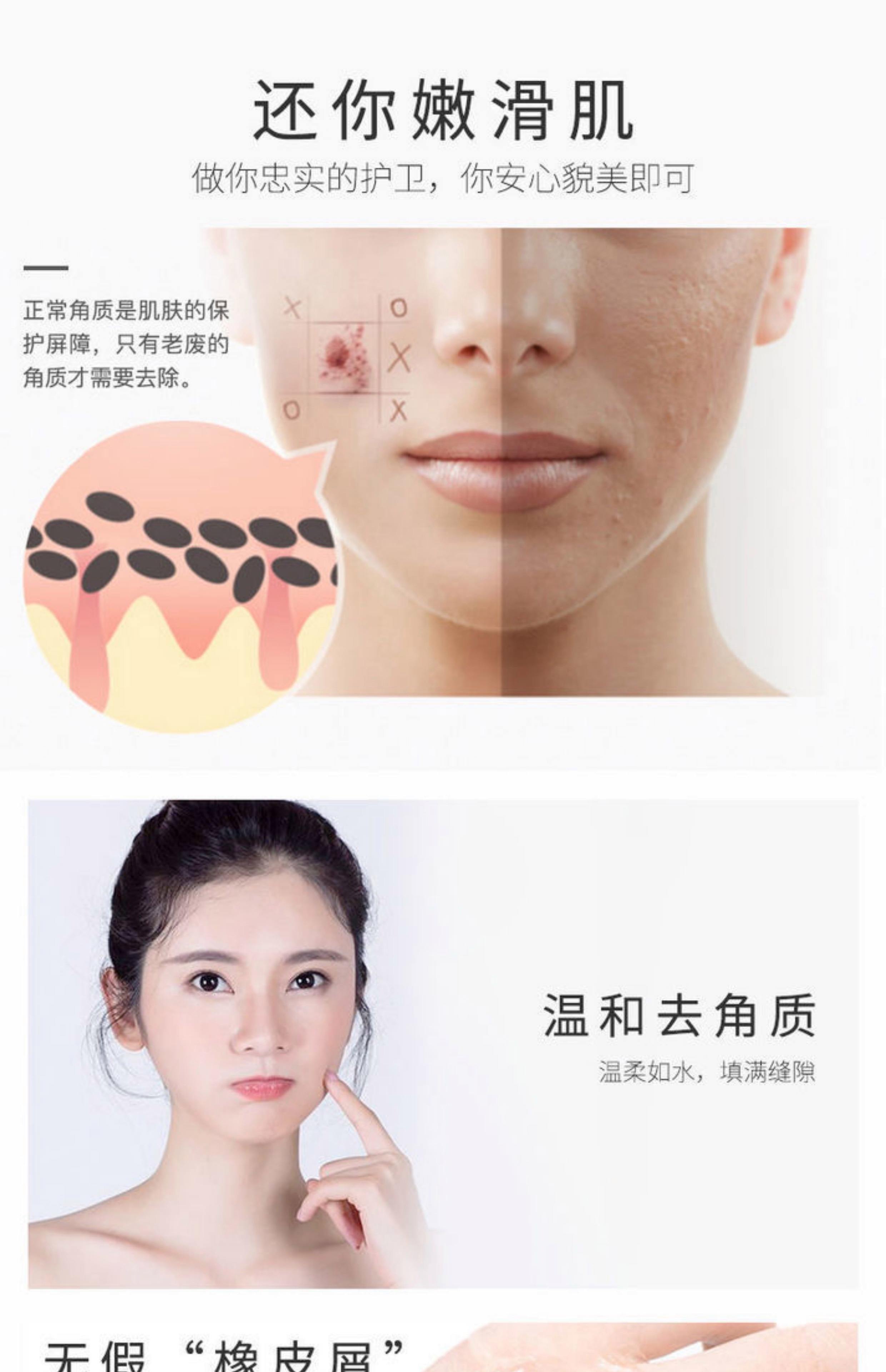 脸上有死皮怎么办