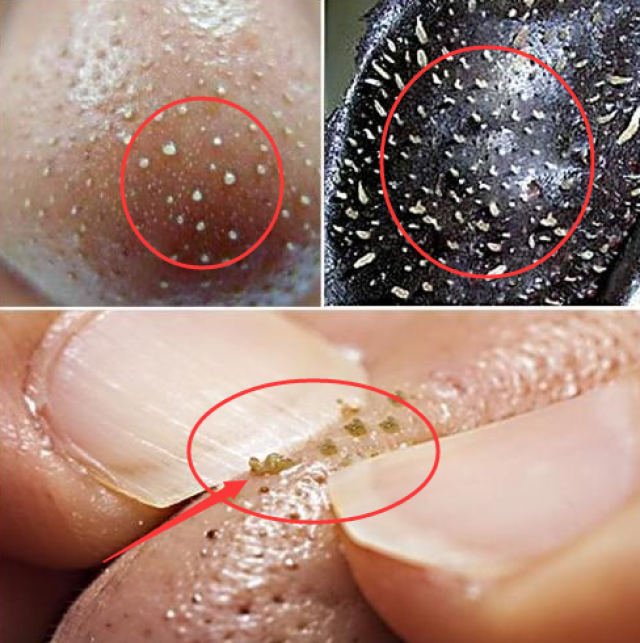 鼻子里有白色粘稠物分泌而出