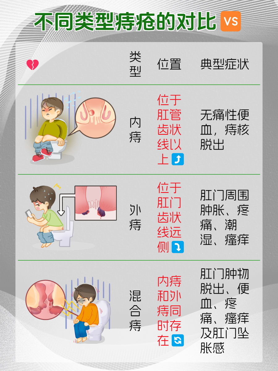 引起痔疮的原因