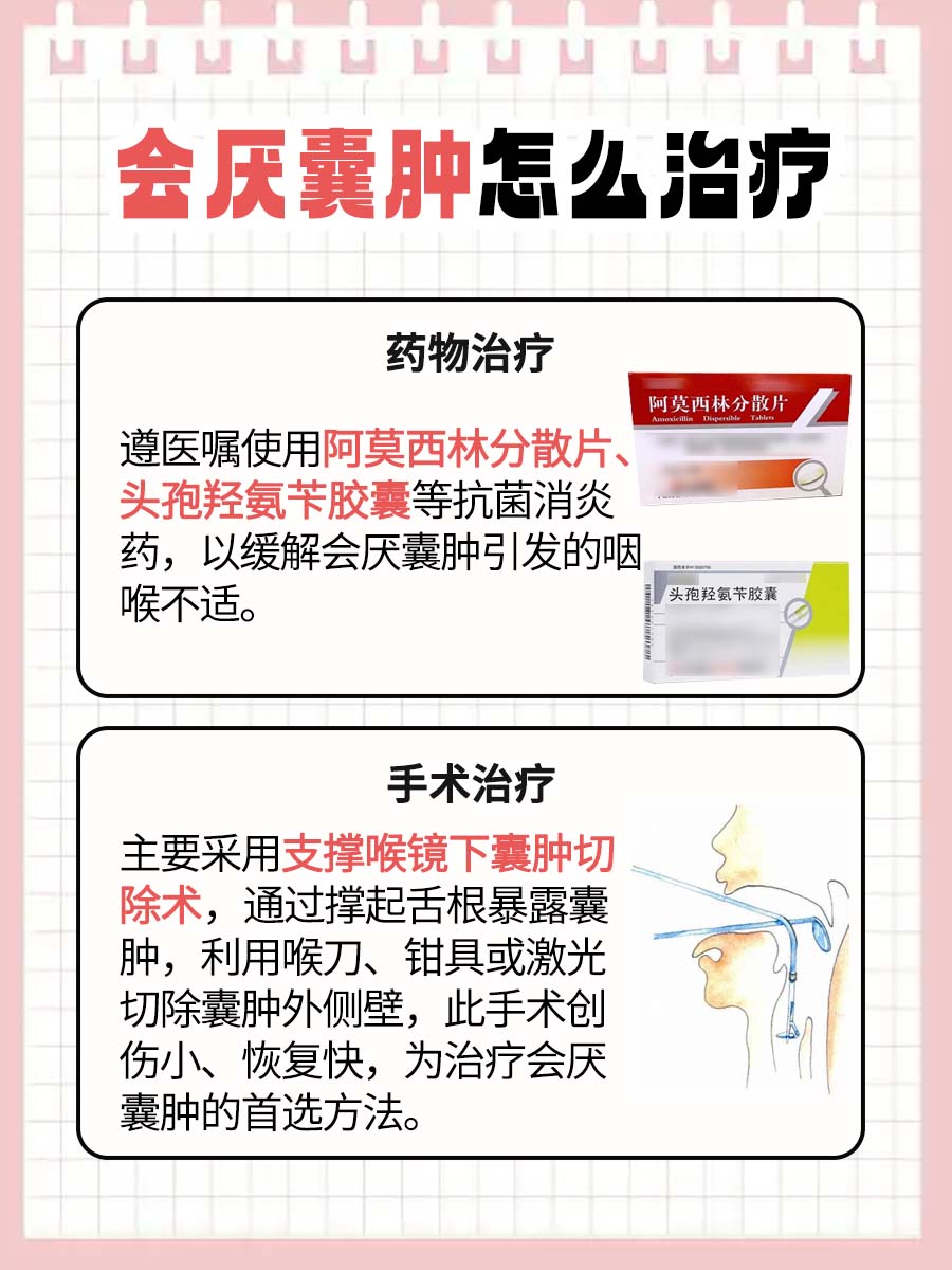 会厌囊肿怎么引起的