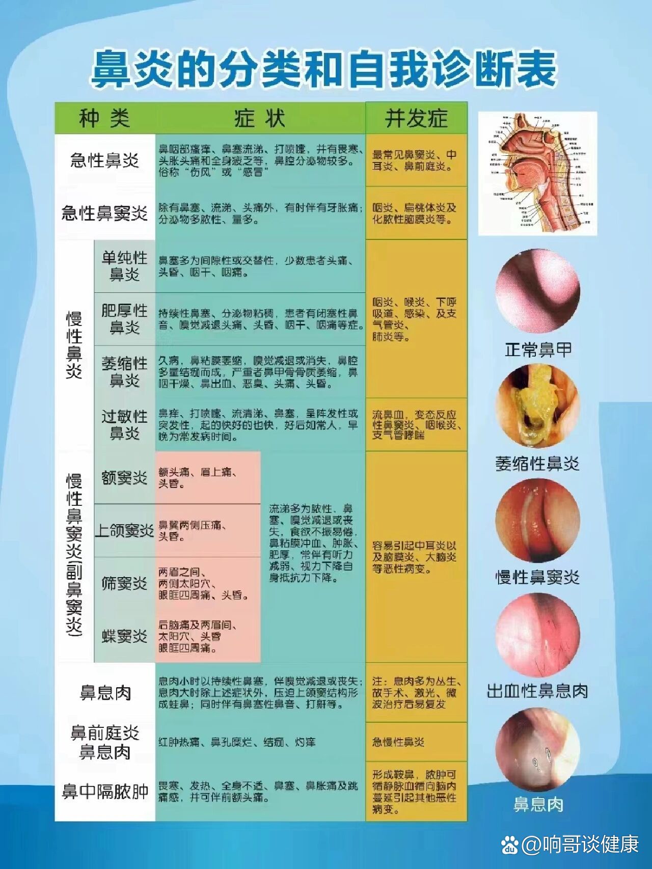 鼻炎的症状和治疗方法