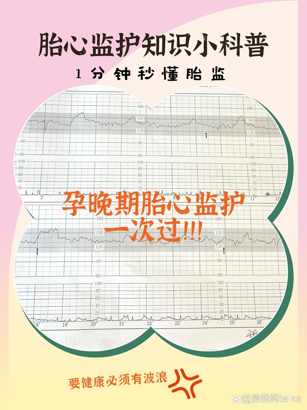 胎心监护要做多长时间