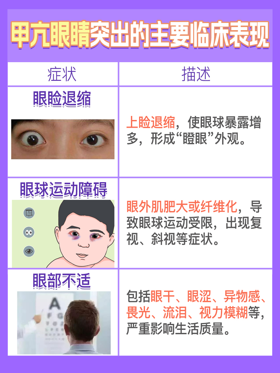 甲状腺亢进有什么症状