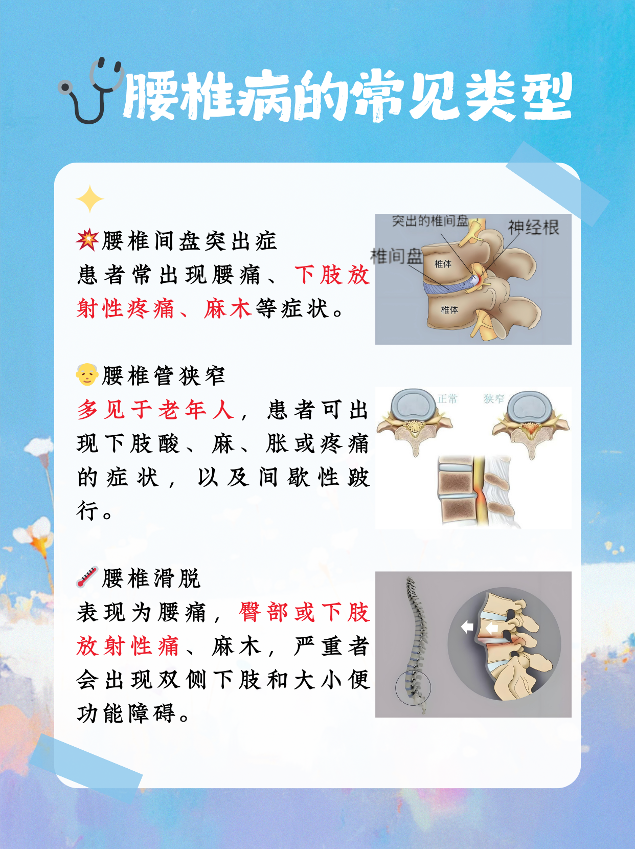腰椎骨质增生的原因