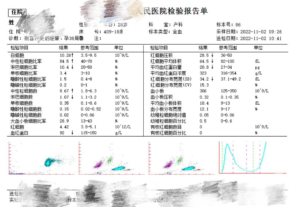 血常规哪项可以看地贫