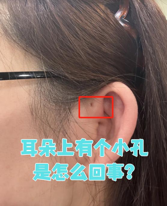 耳朵穿孔怎么修复?