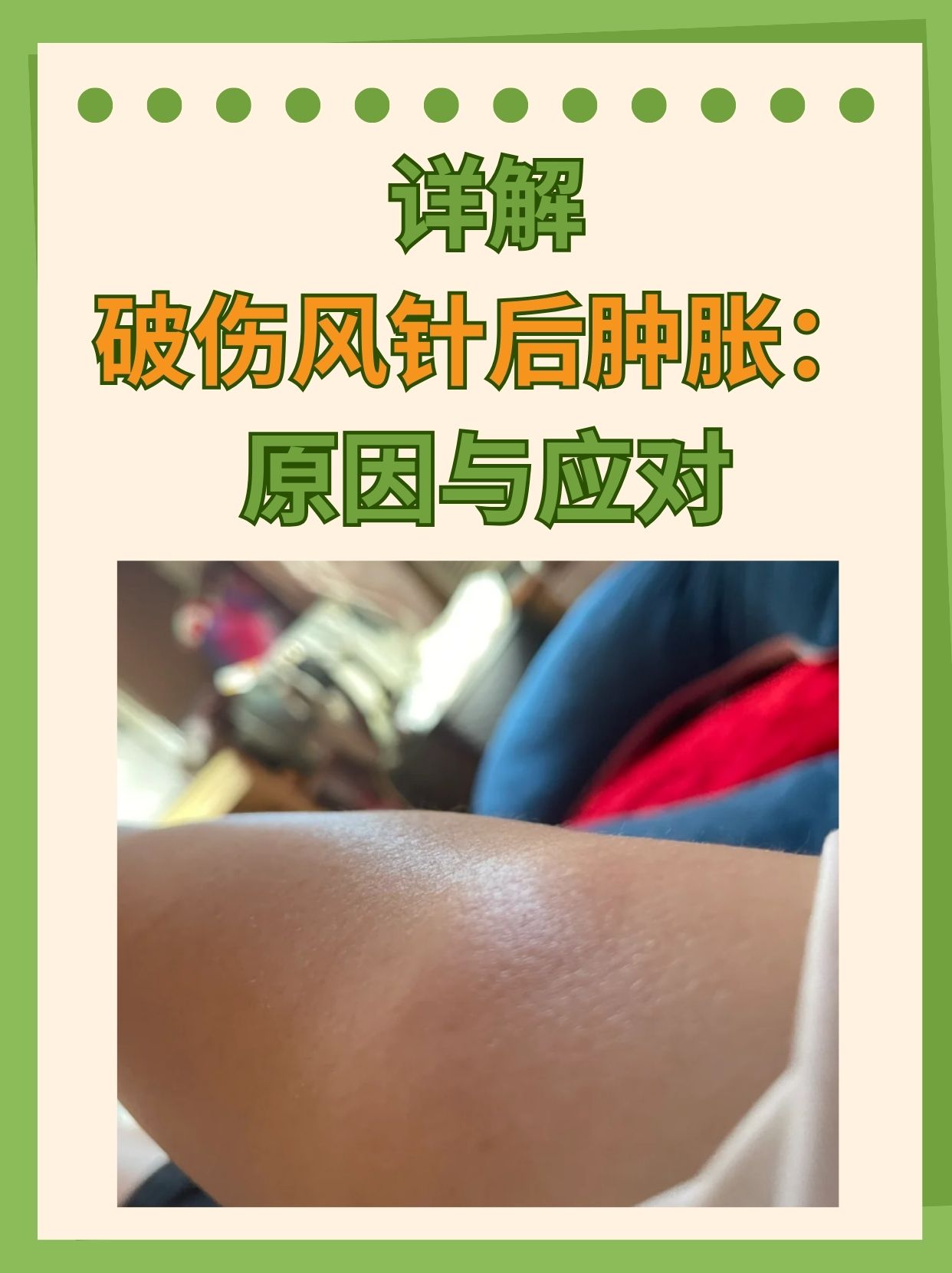打了破伤风针后能喝酒吗