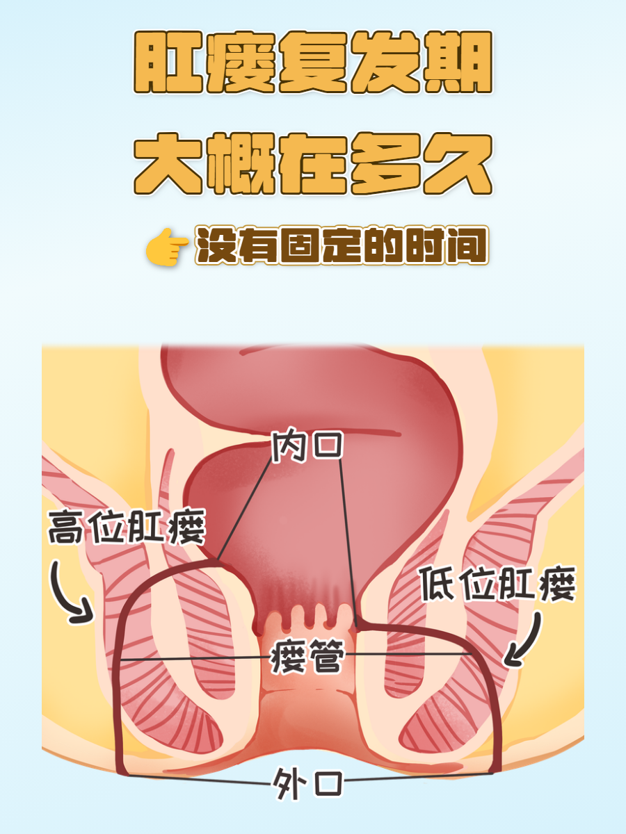 痔疮和肛瘘有什么区别