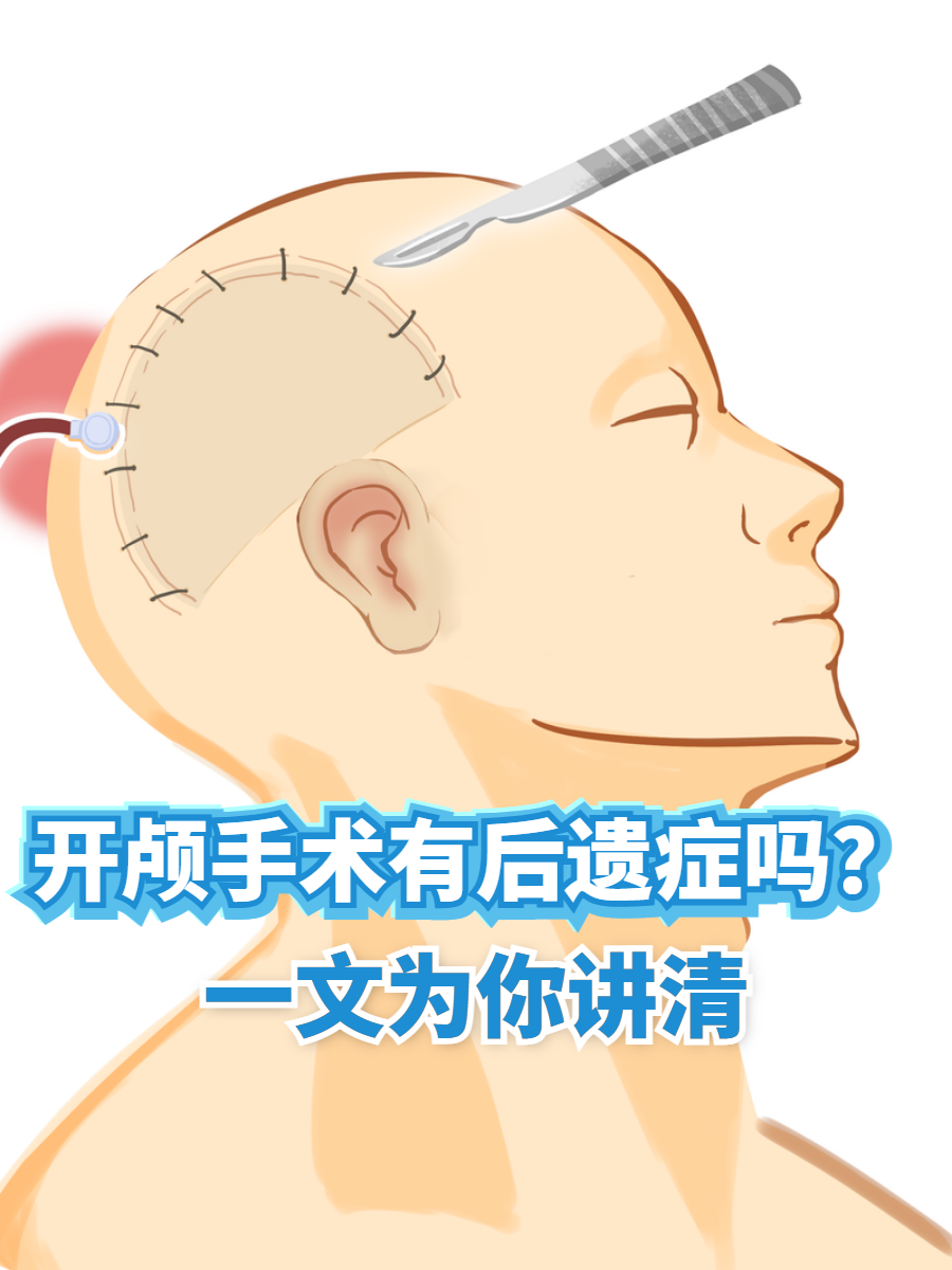 开颅手术有哪些危险