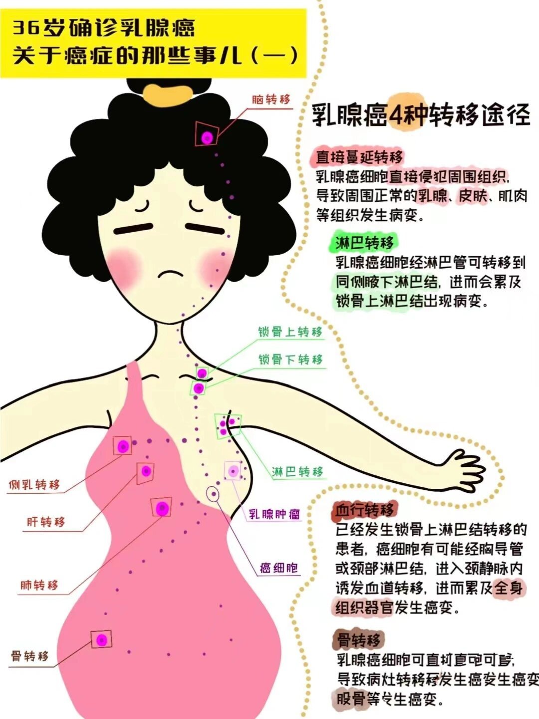 乳腺癌中期症状有哪些?