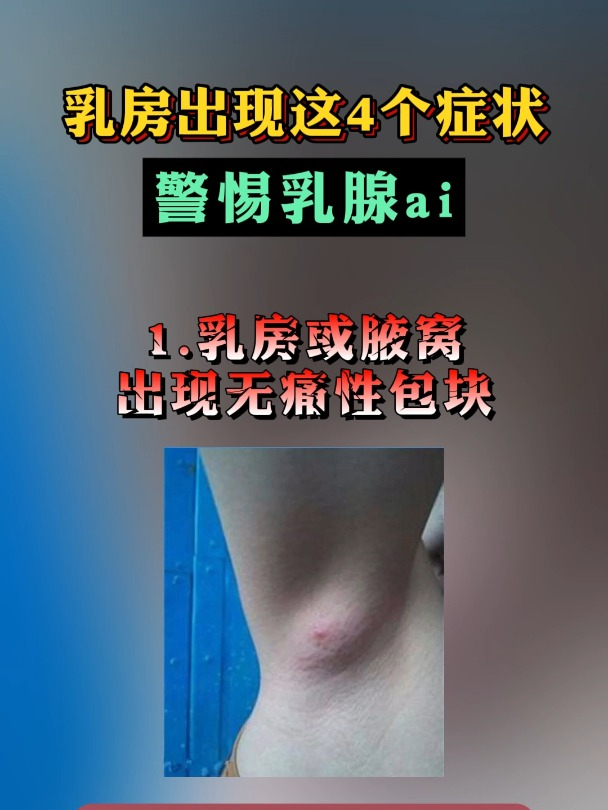 乳腺癌有哪些症状?