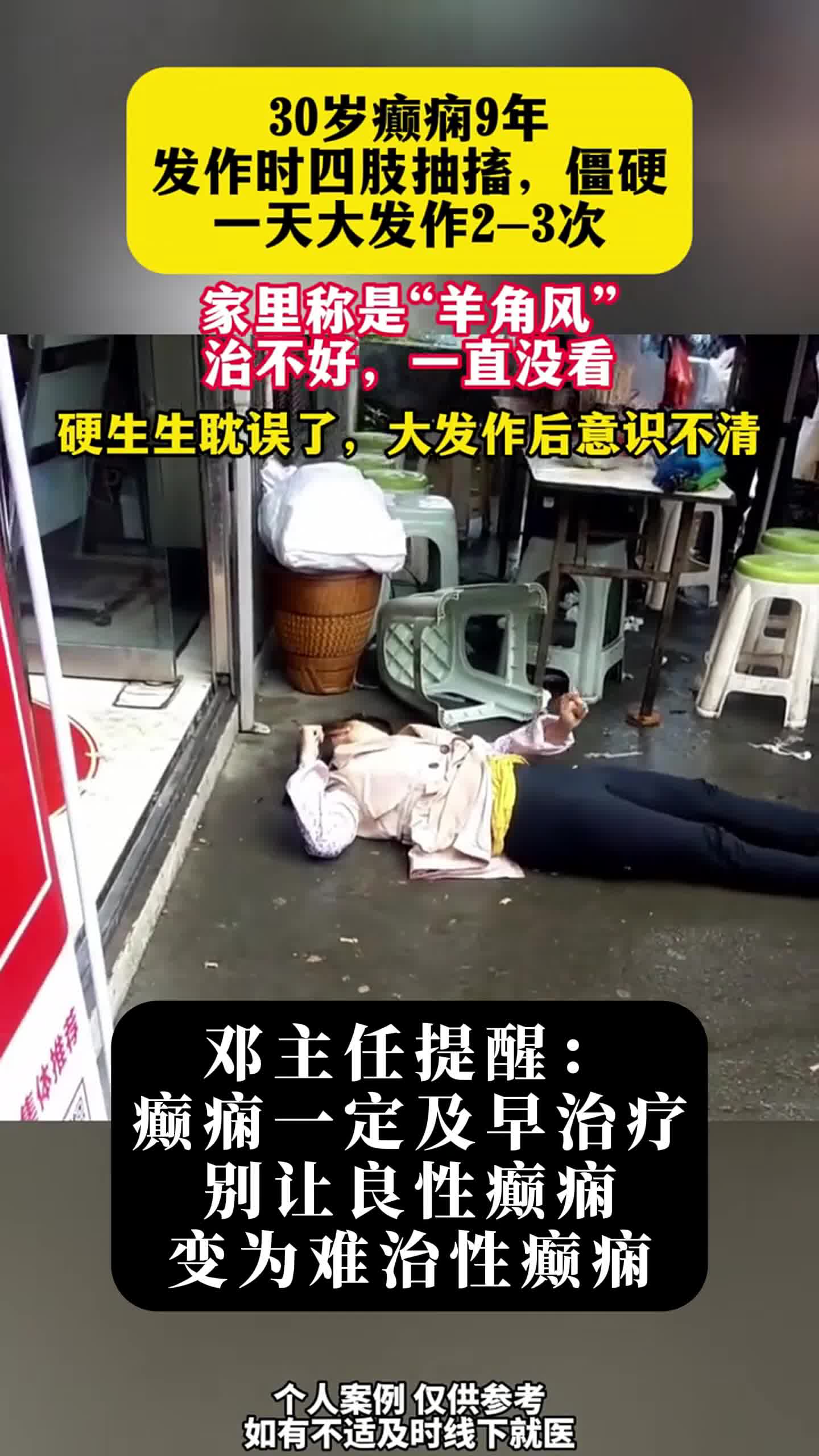 癫痫是什么病