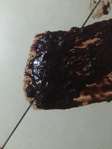 解大便是黑色的是怎么回事