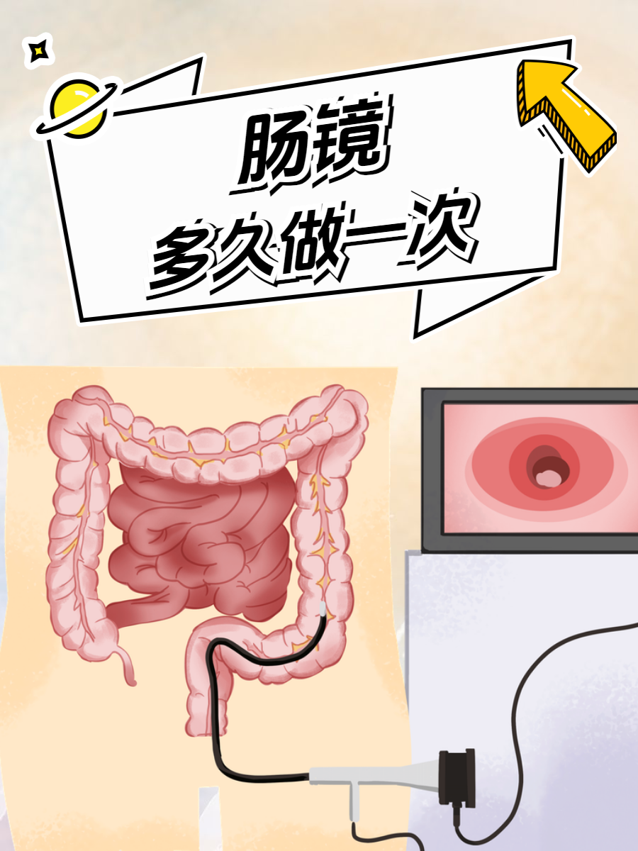 肠镜和结肠镜一样吗?