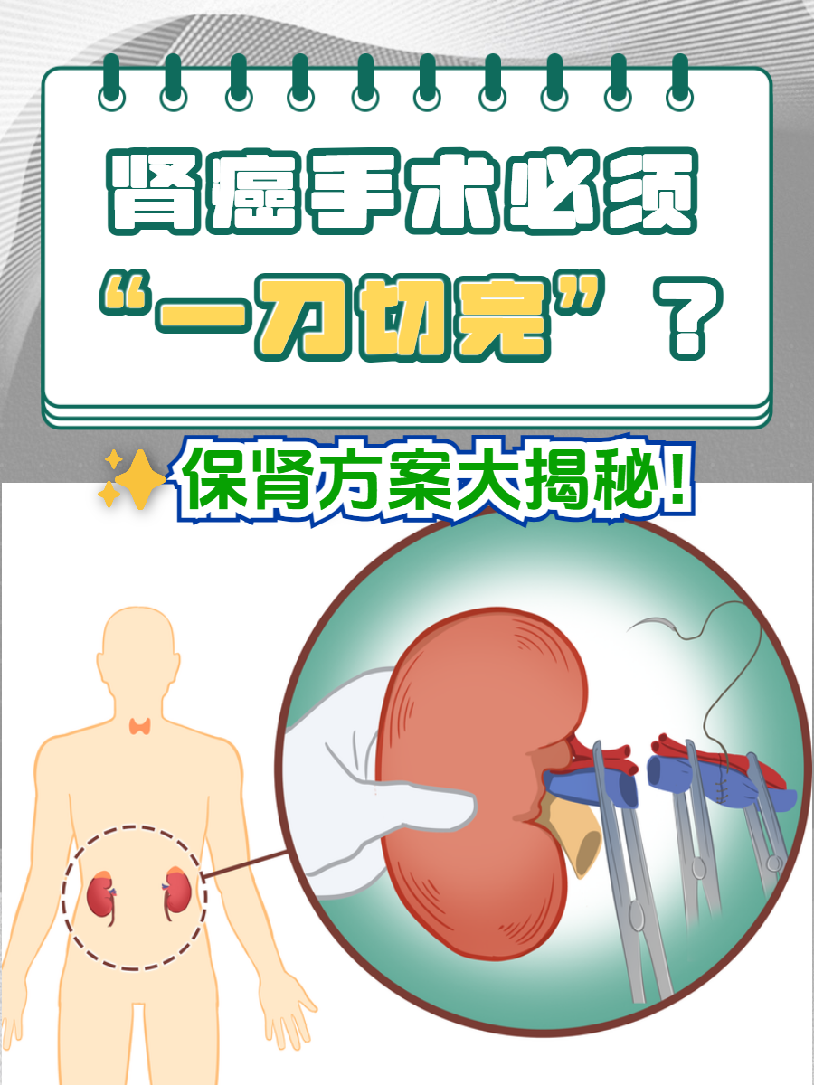 肾肿瘤能治好吗?