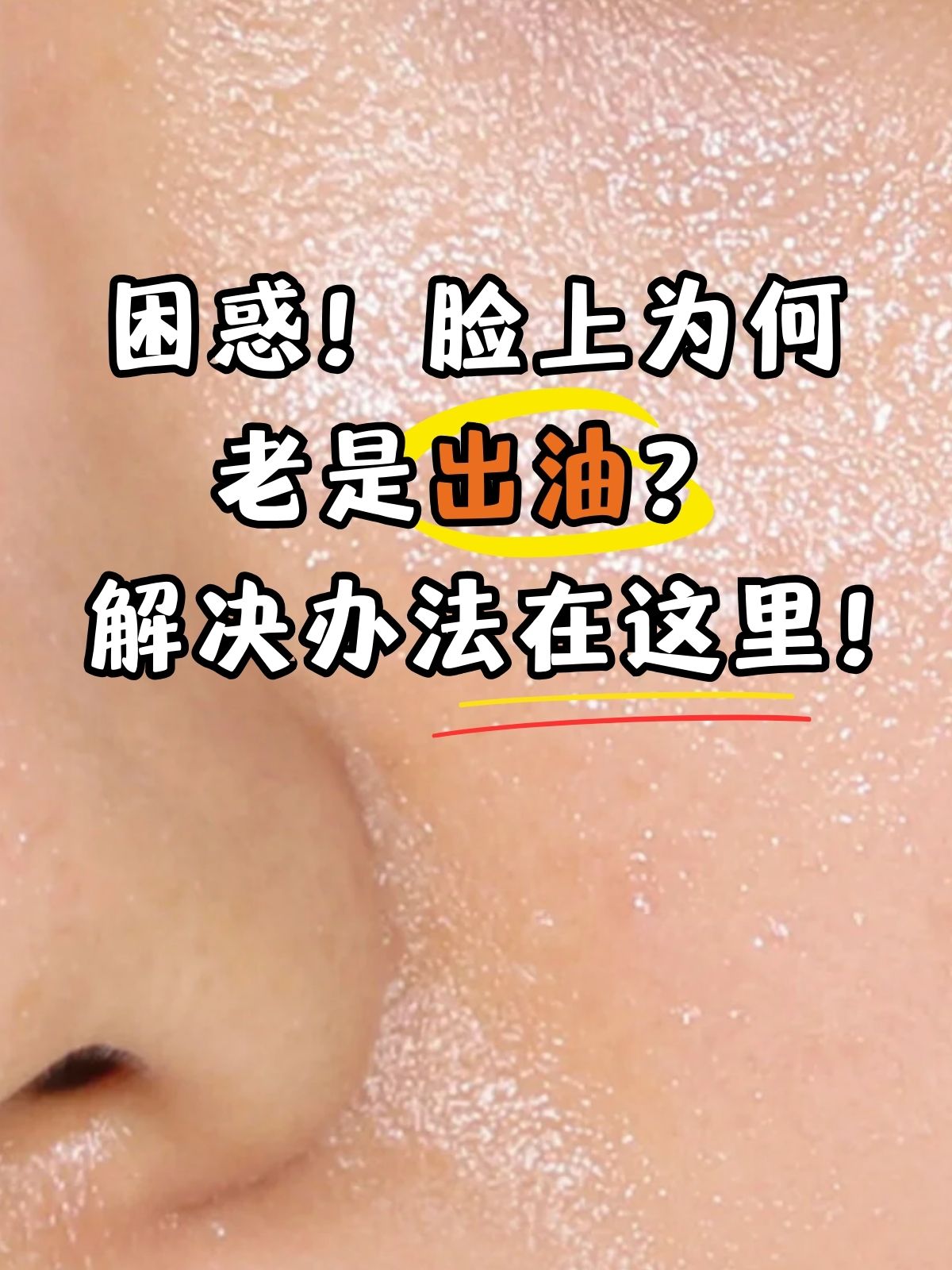 脸部出油多是什么原因