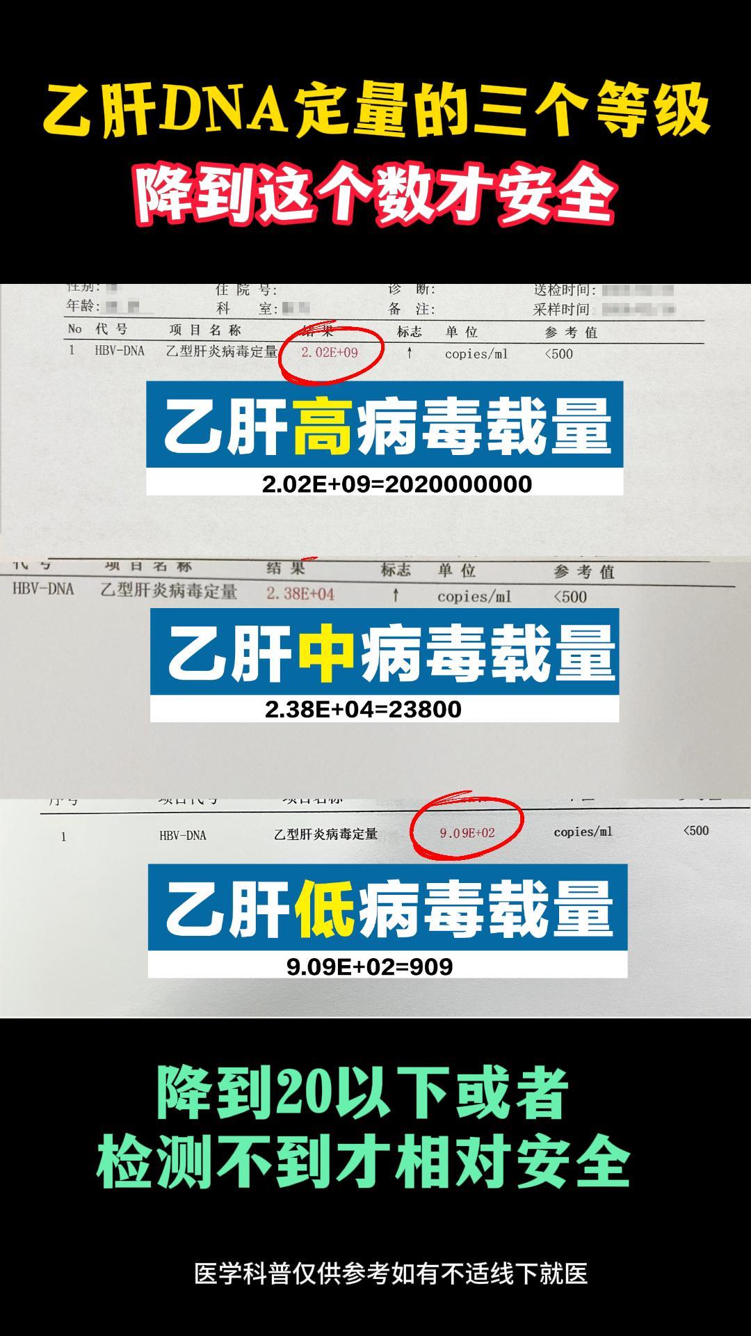 乙肝病毒DNA检测结果怎么看?