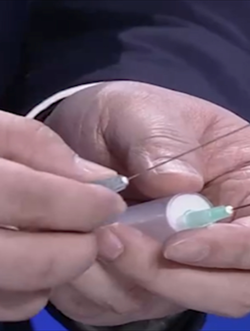 什么是甲状腺穿刺术
