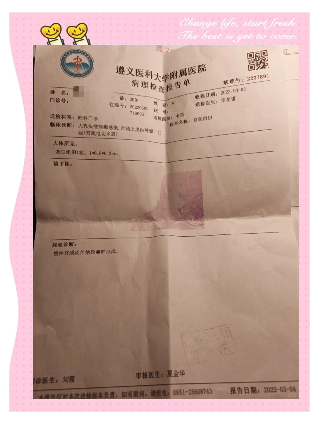 leep刀手术费用要多少