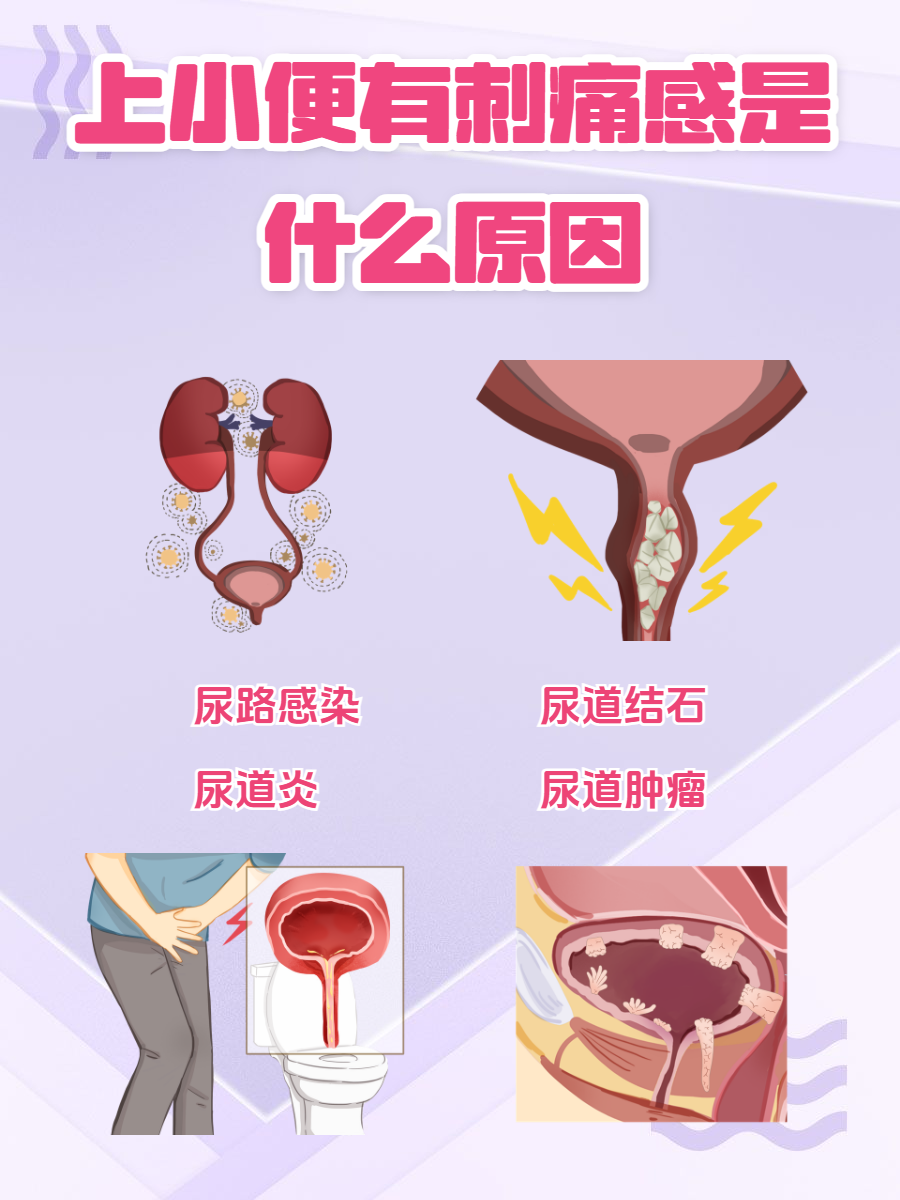 小便时尿道口有灼热感