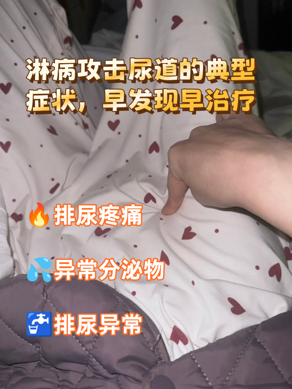 小便时尿道口有灼热感