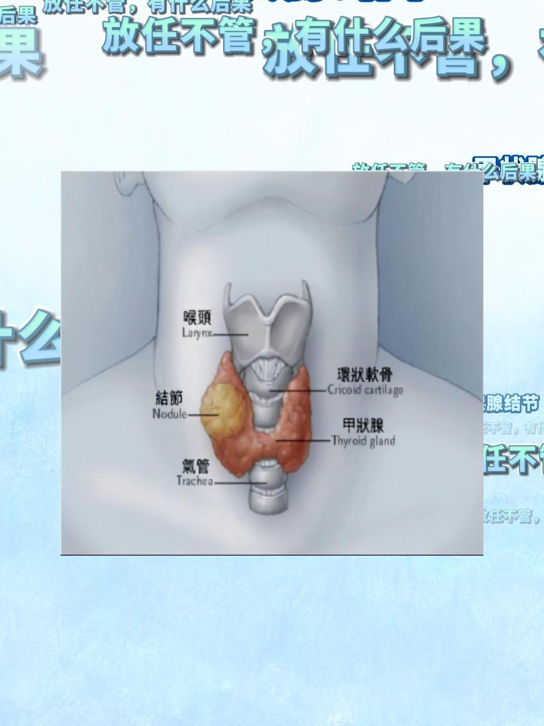 什么是甲状腺囊性结节?