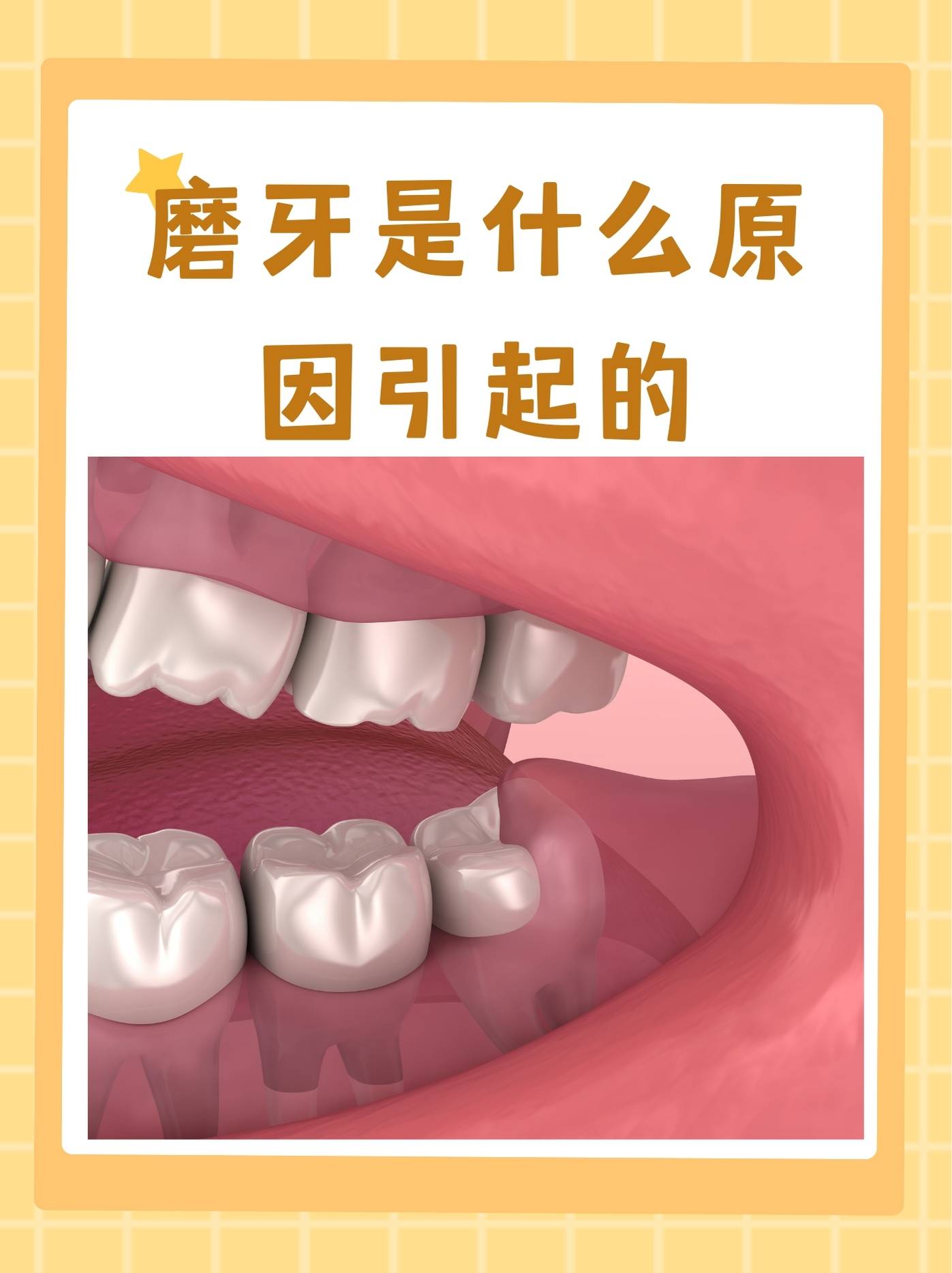 磨牙要怎么治疗