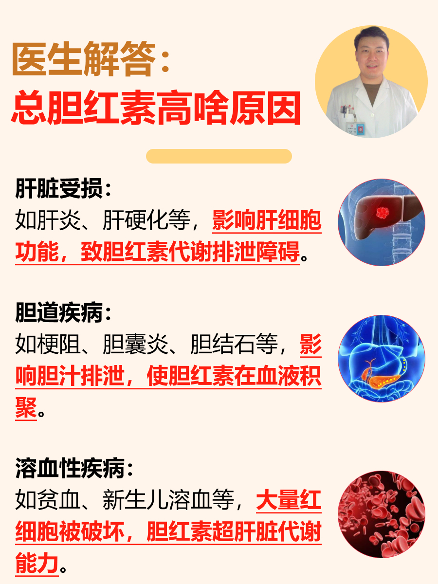 非结合胆红素,是什么