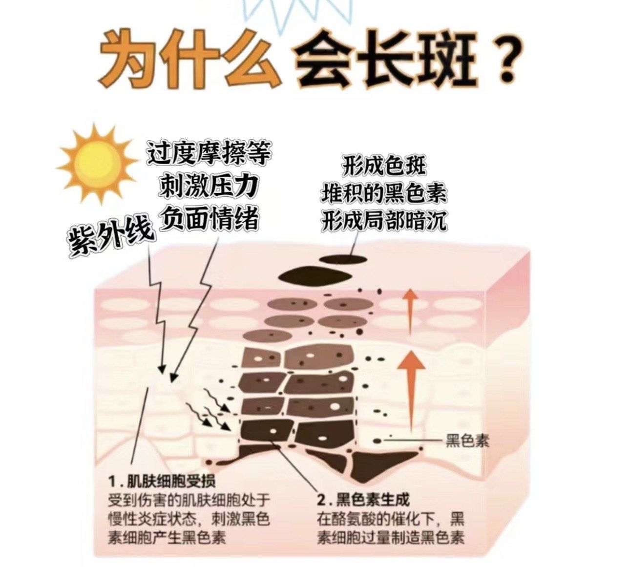 黄褐斑是什么原因导致的