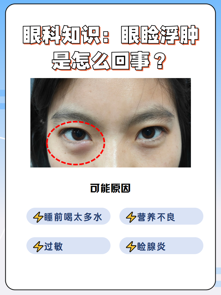 造成水肿的原因有哪些?