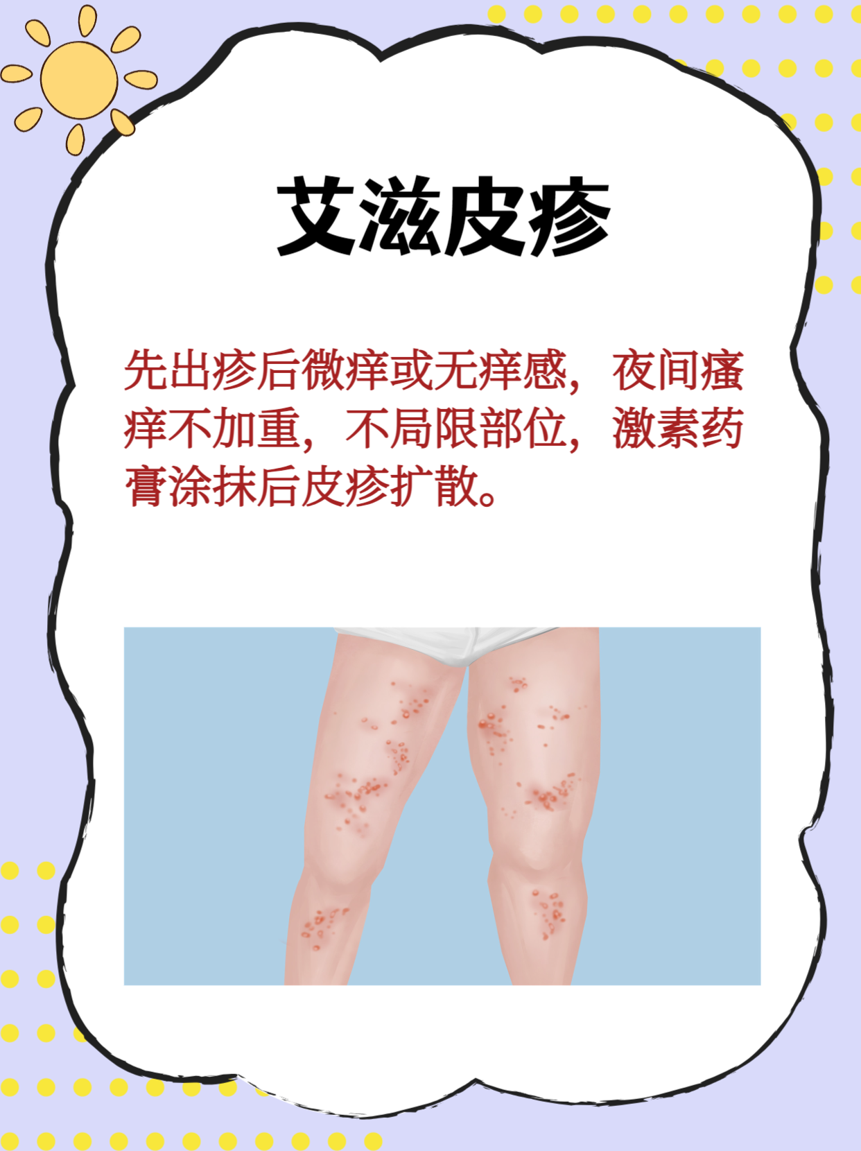 艾滋病急性感染期的症状