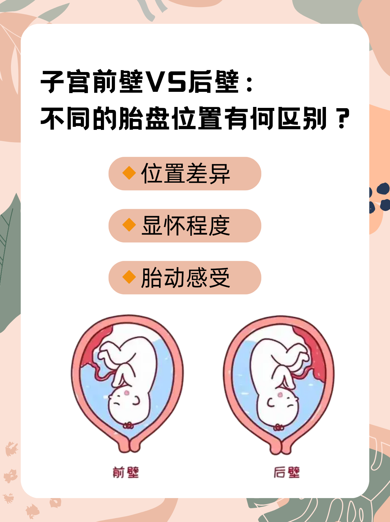 胎盘子宫后壁