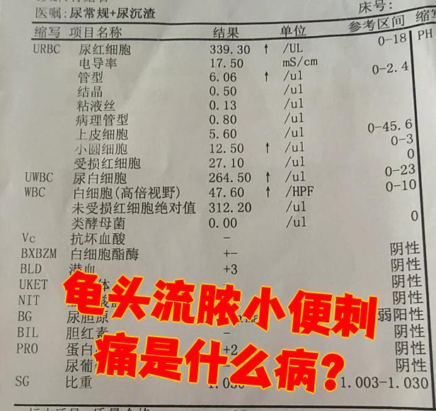 小便刺痛流脓是怎么回事