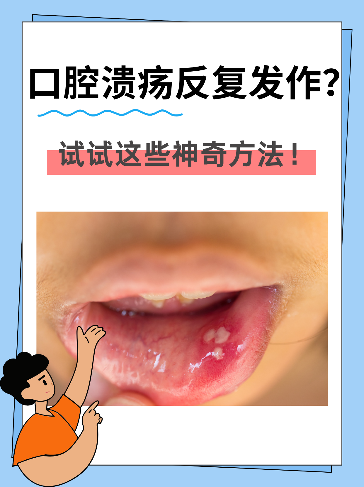 口腔溃疡怎么治疗
