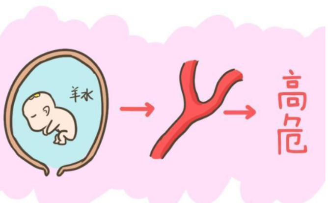 剖宫产会羊水栓塞吗
