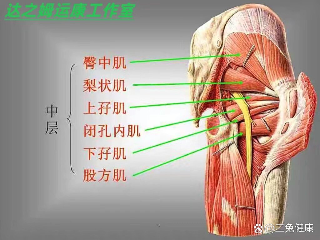 臀中肌综合症