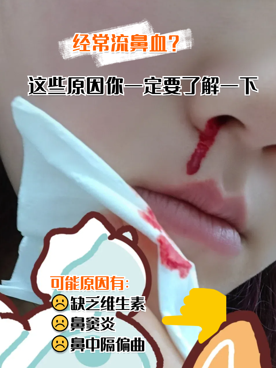 一直流鼻血是什么症状