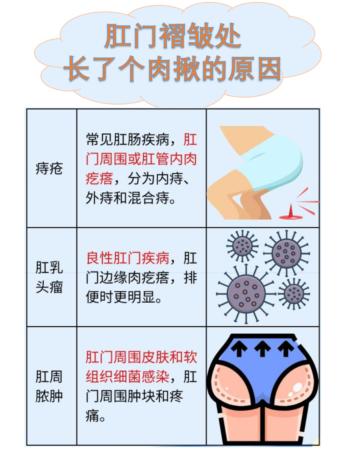 肛门息肉怎么治疗比较好?