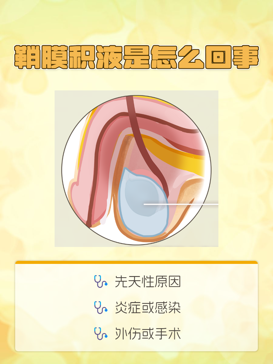 鞘膜积液是怎么造成的
