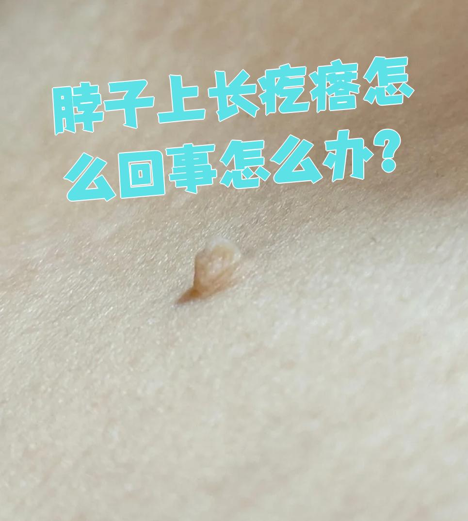 脖子上长了小疙瘩是什么