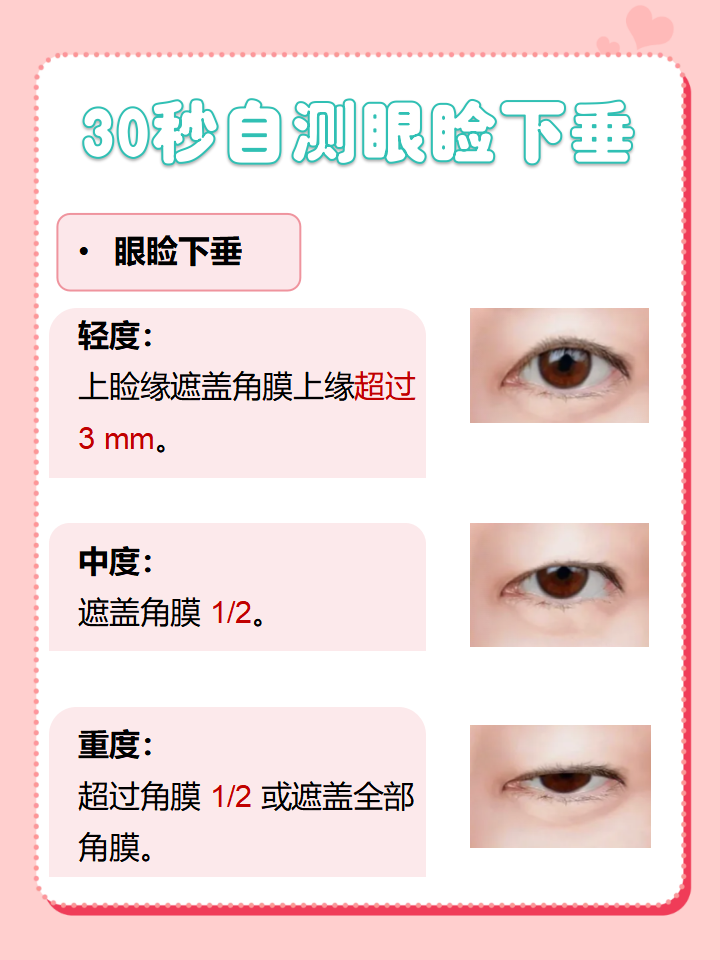 什么是眼睑肌无力