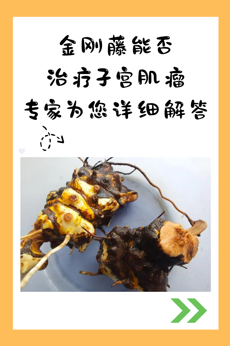 子宫肌瘤可以治愈吗